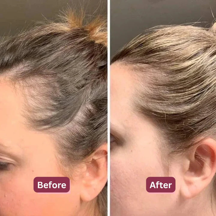 Before and after results for Diane M., 38, Phoenix AZ