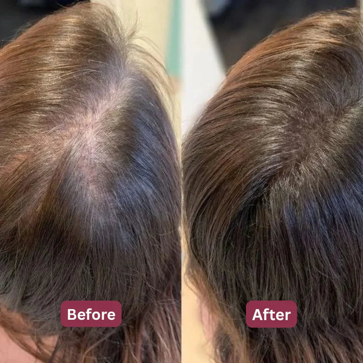 Before and after results for Sharon D., 38, Chicago IL