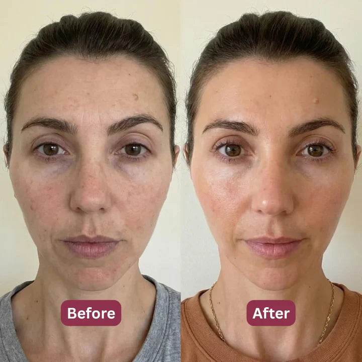 Before and after results for Linda K., 44, Dallas TX